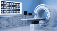 CT Scan MI 1