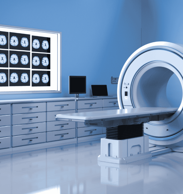 CT Scan MI 1
