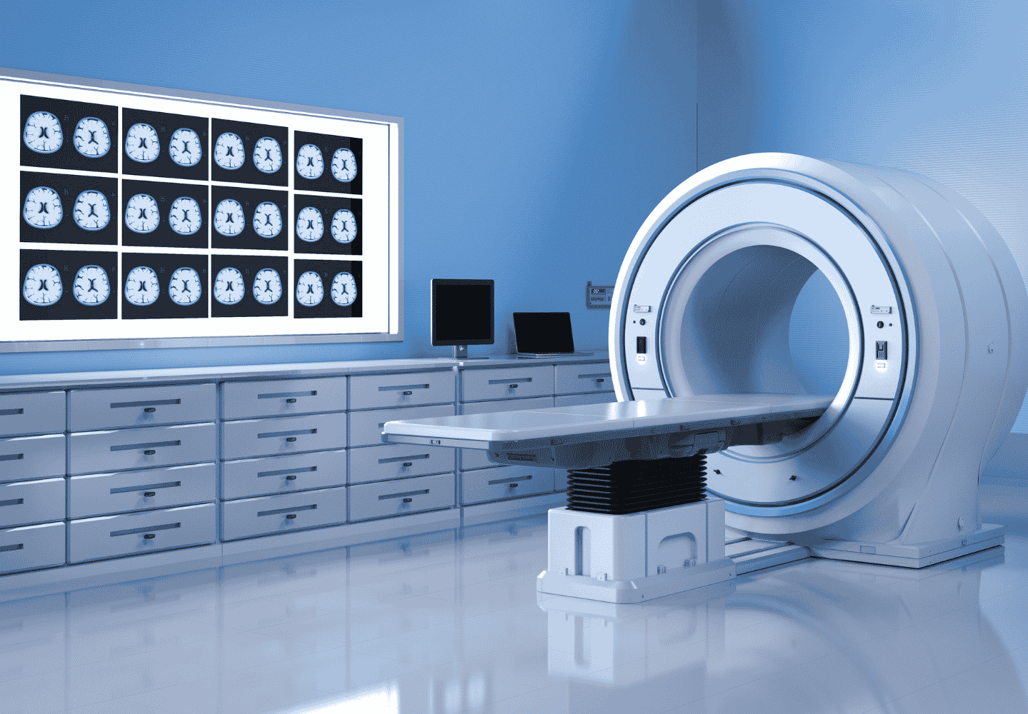 CT Scan MI 1